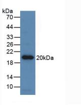 Monoclonal Antibody to Erythropoietin (EPO)