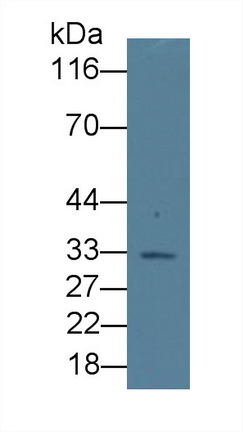 Monoclonal Antibody to Erythropoietin (EPO)