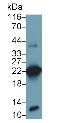 Monoclonal Antibody to Growth Hormone (GH)