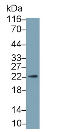 Monoclonal Antibody to Growth Hormone (GH)