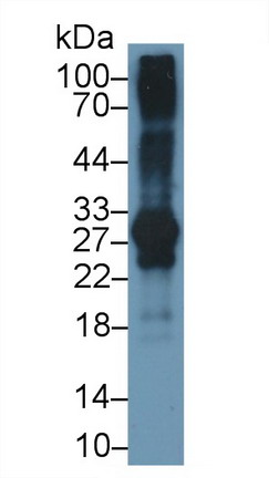 Monoclonal Antibody to Insulin Like Growth Factor Binding Protein 1 (IGFBP1)