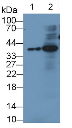 Monoclonal Antibody to Insulin Like Growth Factor Binding Protein 3 (IGFBP3)