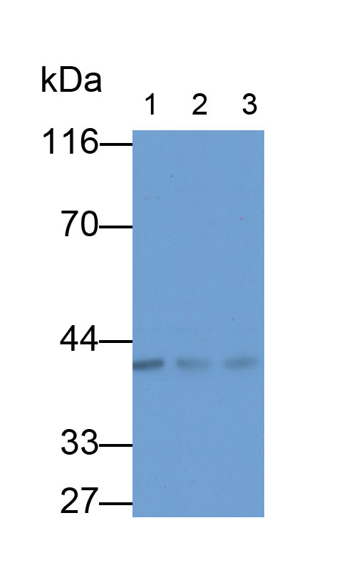 Monoclonal Antibody to Insulin Like Growth Factor Binding Protein 3 (IGFBP3)