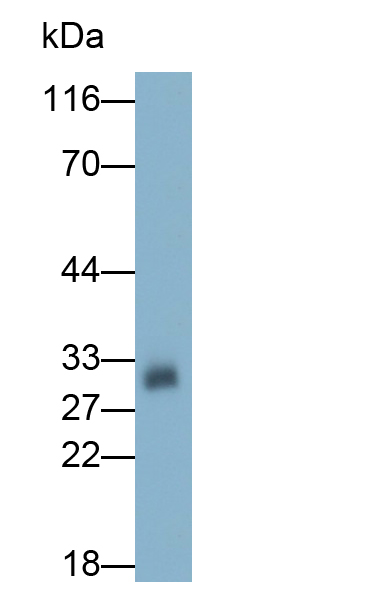 Monoclonal Antibody to Insulin Like Growth Factor Binding Protein 4 (IGFBP4)