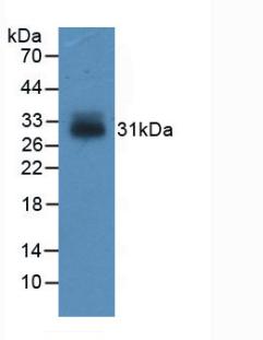 Monoclonal Antibody to Insulin Like Growth Factor Binding Protein 4 (IGFBP4)