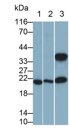 Monoclonal Antibody to Interleukin 11 (IL11)