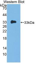 Monoclonal Antibody to Interleukin 12A (IL12A)