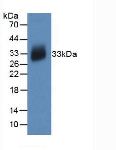 Monoclonal Antibody to Interleukin 12A (IL12A)