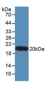 Monoclonal Antibody to Interleukin 17 (IL17)