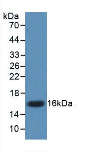 Monoclonal Antibody to Interleukin 17 (IL17)