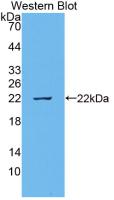 Monoclonal Antibody to Interleukin 18 (IL18)