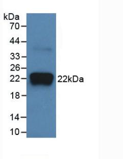 Monoclonal Antibody to Interleukin 18 (IL18)