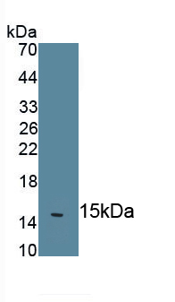 Monoclonal Antibody to Interleukin 18 (IL18)