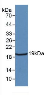 Monoclonal Antibody to Interleukin 18 (IL18)