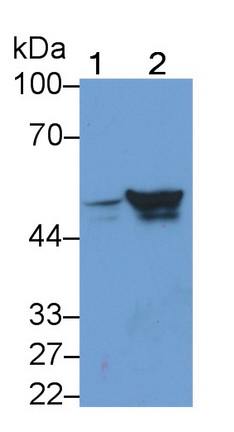 Monoclonal Antibody to Glial Fibrillary Acidic Protein (GFAP)