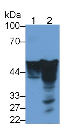 Monoclonal Antibody to Glial Fibrillary Acidic Protein (GFAP)