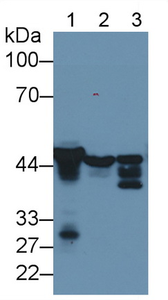 Monoclonal Antibody to Glial Fibrillary Acidic Protein (GFAP)