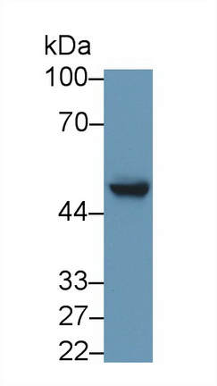 Monoclonal Antibody to Glial Fibrillary Acidic Protein (GFAP)