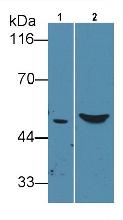 Monoclonal Antibody to Glial Fibrillary Acidic Protein (GFAP)