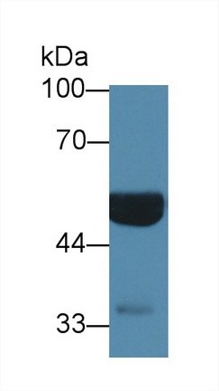 Monoclonal Antibody to Glial Fibrillary Acidic Protein (GFAP)