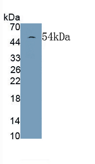 Monoclonal Antibody to Glial Fibrillary Acidic Protein (GFAP)