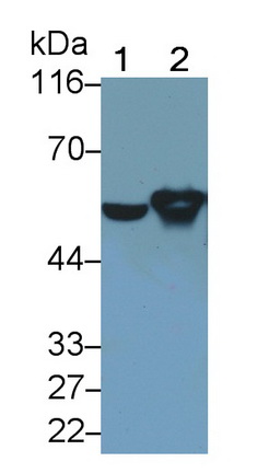 Monoclonal Antibody to Glial Fibrillary Acidic Protein (GFAP)