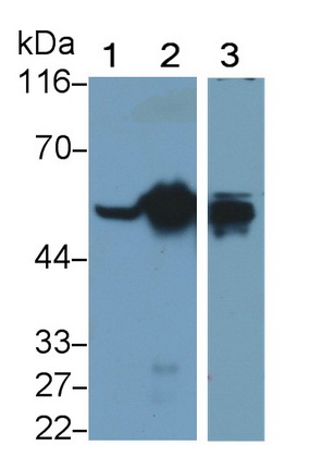 Monoclonal Antibody to Glial Fibrillary Acidic Protein (GFAP)