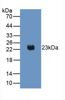 Monoclonal Antibody to Interleukin 2 (IL2)