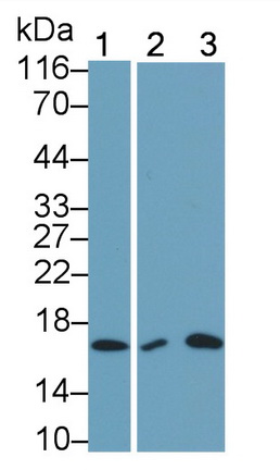 Monoclonal Antibody to Interleukin 5 (IL5)