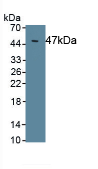 Monoclonal Antibody to Interleukin 6 (IL6)