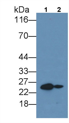 Monoclonal Antibody to Interleukin 6 (IL6)