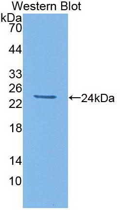 Monoclonal Antibody to Interleukin 6 (IL6)