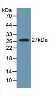 Monoclonal Antibody to Interleukin 6 (IL6)