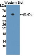 Monoclonal Antibody to Interleukin 6 (IL6)