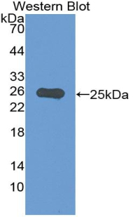 Monoclonal Antibody to Interleukin 6 (IL6)