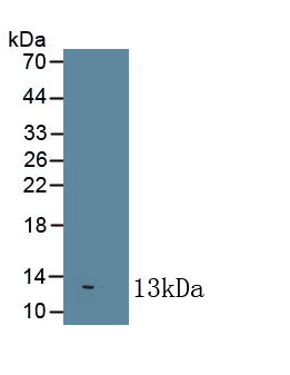 Monoclonal Antibody to Interleukin 8 (IL8)