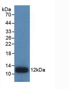 Monoclonal Antibody to Interleukin 8 (IL8)