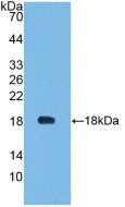 Monoclonal Antibody to Leptin (LEP)