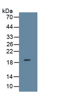 Monoclonal Antibody to Leptin (LEP)