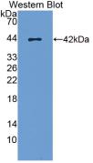 Monoclonal Antibody to Monocyte Chemotactic Protein 1 (MCP1)