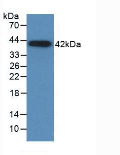 Monoclonal Antibody to Monocyte Chemotactic Protein 1 (MCP1)