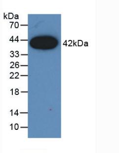 Monoclonal Antibody to Monocyte Chemotactic Protein 1 (MCP1)