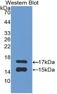 Monoclonal Antibody to Monocyte Chemotactic Protein 1 (MCP1)