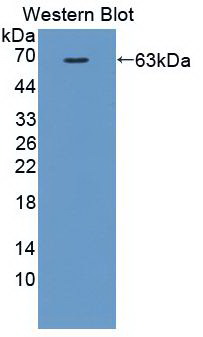 Monoclonal Antibody to Matrix Metalloproteinase 2 (MMP2)