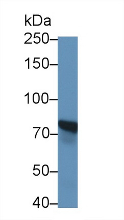 Monoclonal Antibody to Matrix Metalloproteinase 2 (MMP2)