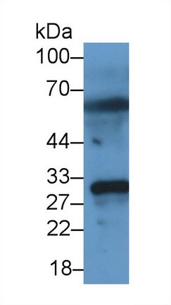 Monoclonal Antibody to Matrix Metalloproteinase 7 (MMP7)