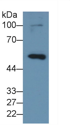 Monoclonal Antibody to Matrix Metalloproteinase 8 (MMP8)