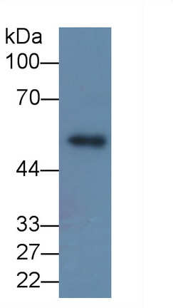 Monoclonal Antibody to Matrix Metalloproteinase 8 (MMP8)