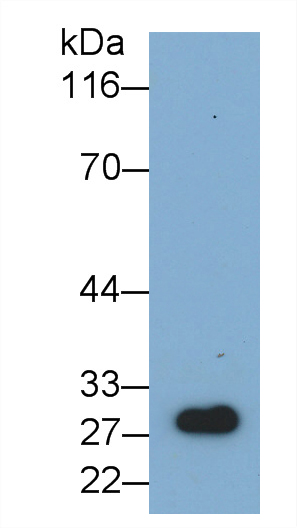 Monoclonal Antibody to Nerve Growth Factor (NGF)