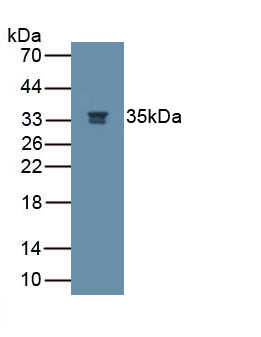 Monoclonal Antibody to Nerve Growth Factor (NGF)